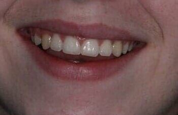 White Teeth — dental care in Wenatchee, WA